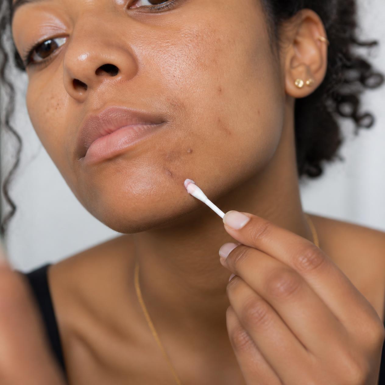 REPLENIX Targeted Blemish Treatment