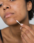 REPLENIX Targeted Blemish Treatment