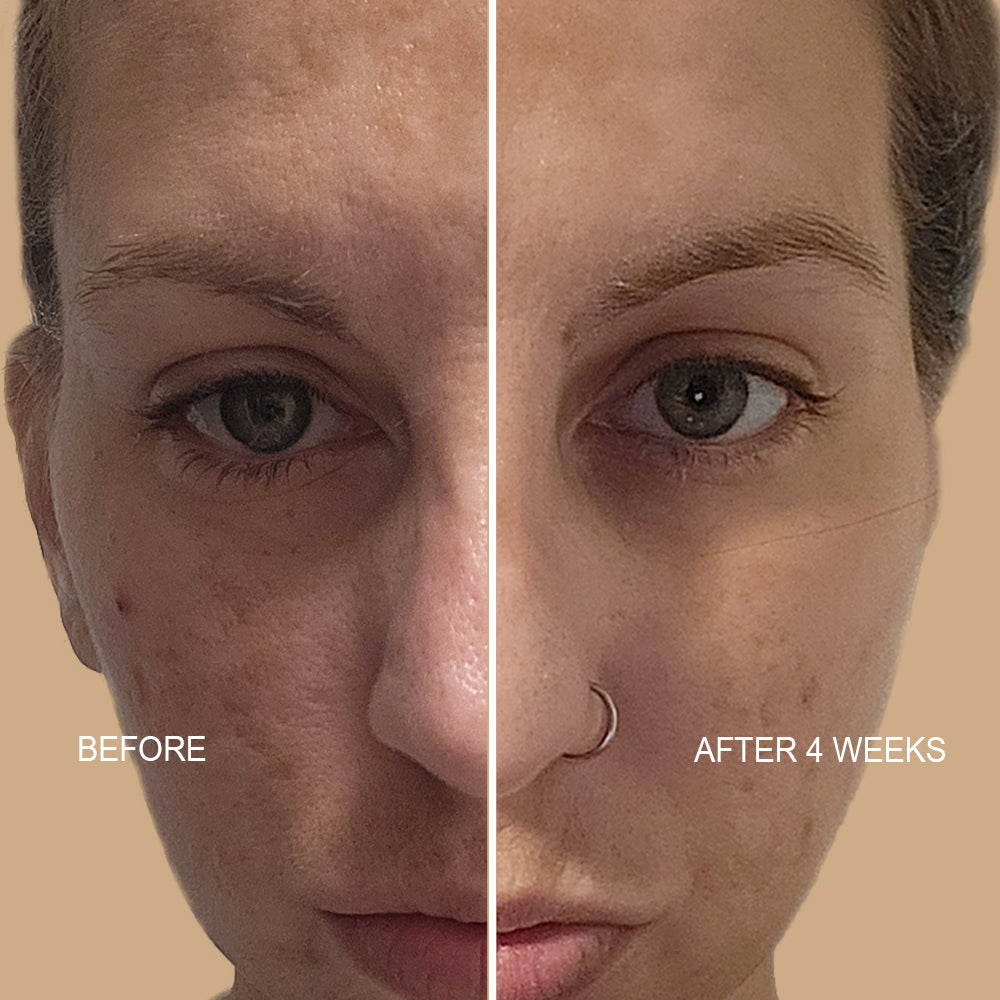 Pore Minimizing Serum