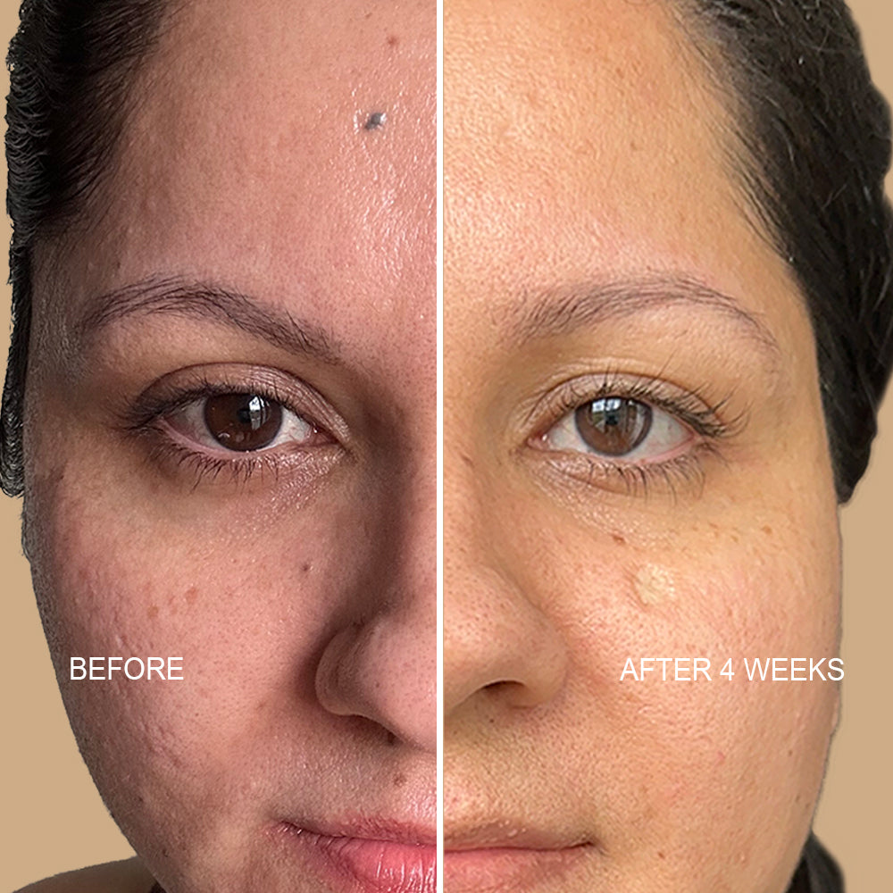 Pore Minimizing Serum