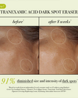 Replenix Tranexamic Acid Dark Spot Corrector